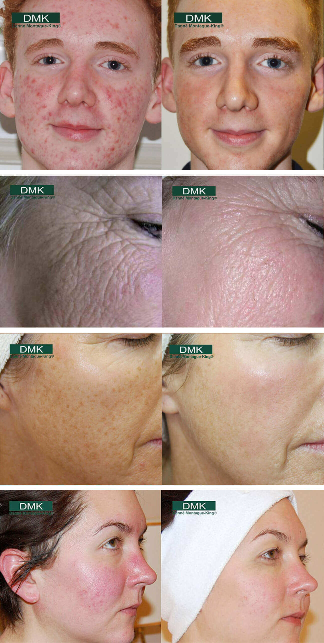 Skin treatment education